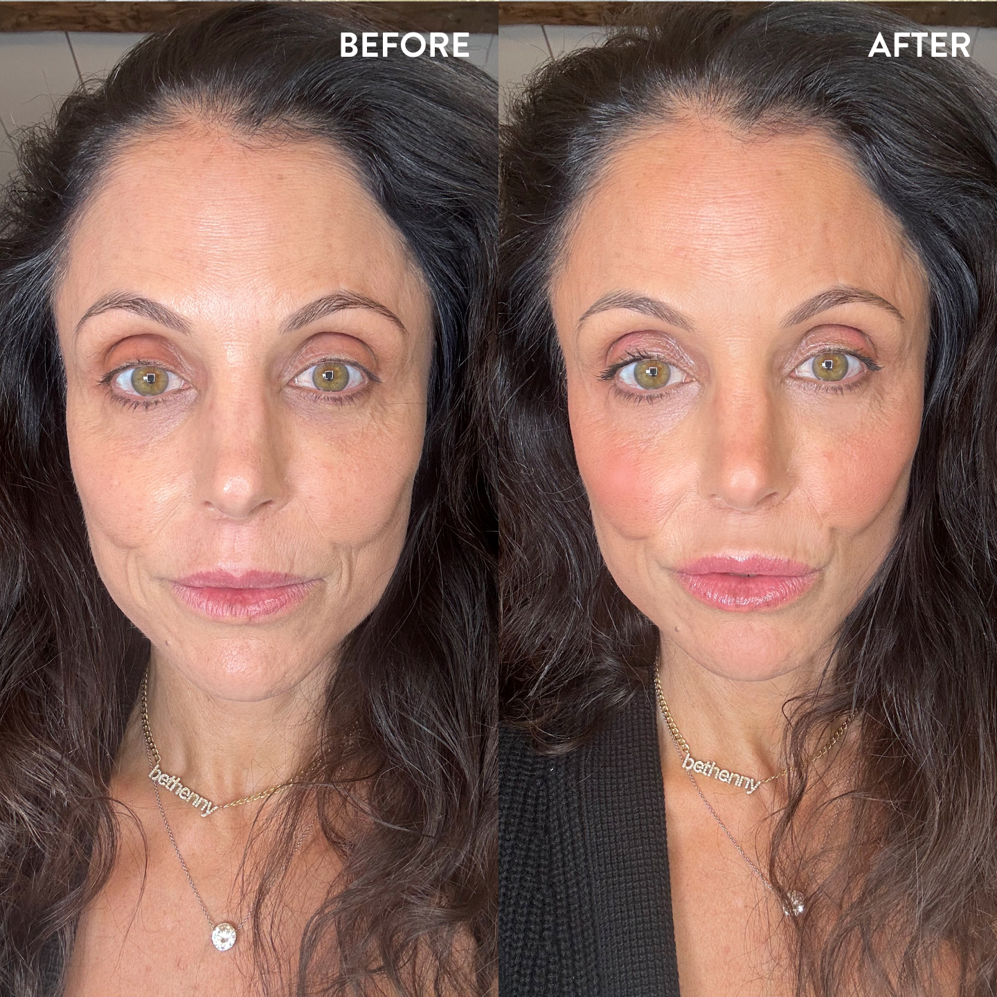 Bethenny Frankel before and after