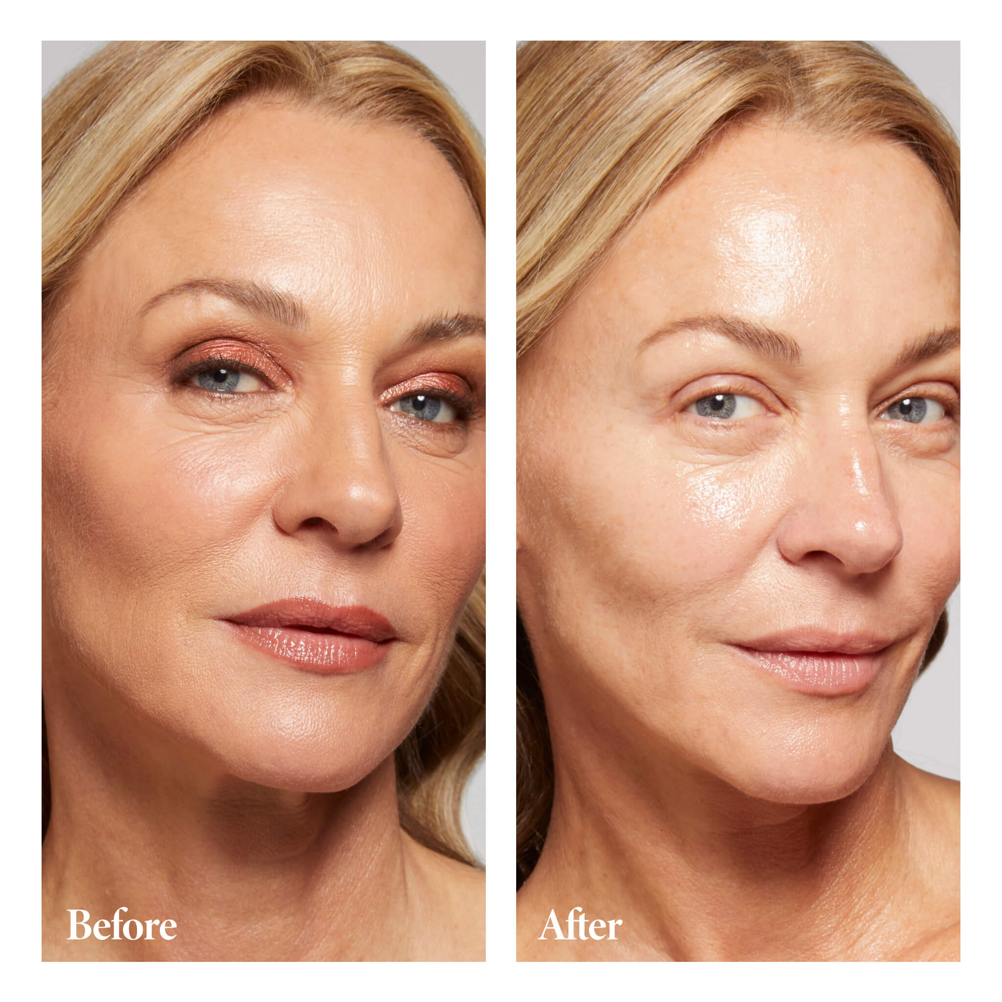 Cold Cream - B&A Model