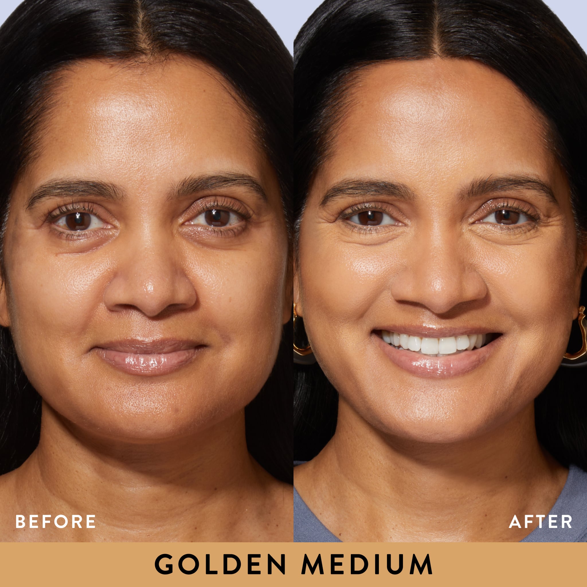 Ideal Fix Concealer Model B&A in golden medium