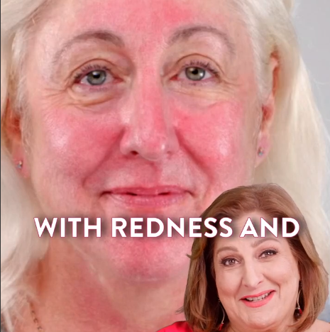 How to Calm and Cover Redness