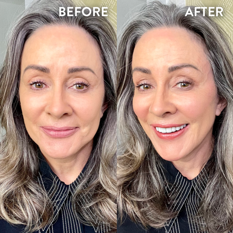 Patricia Heaton Before and After 