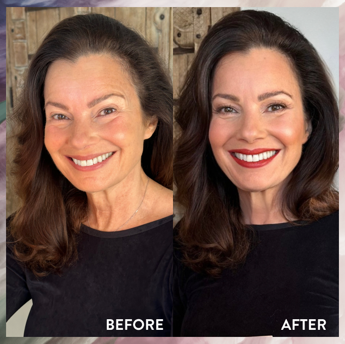 Fran Drescher before and after using the baked starter kit
