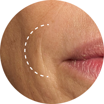 PLP Category Icon - Fine Lines