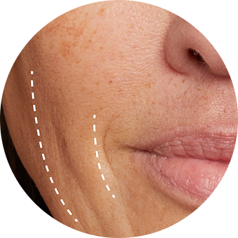 PLP Category Icon - Sallow Skin