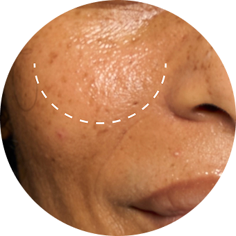PLP Category Icon - Sensitive Skin