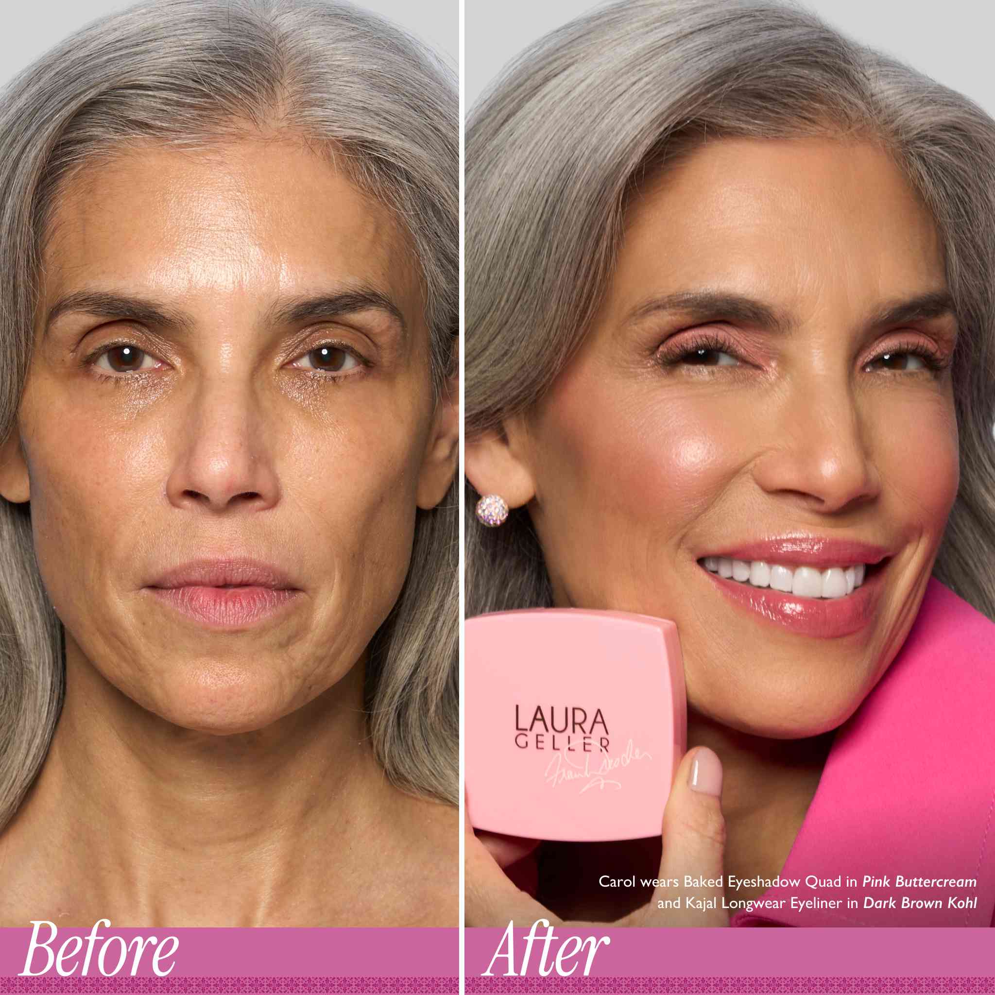 Cancer Schmancer Kit - Model B&A