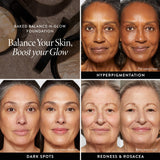 Balance-n-Glow Model Skin Concerns Chart