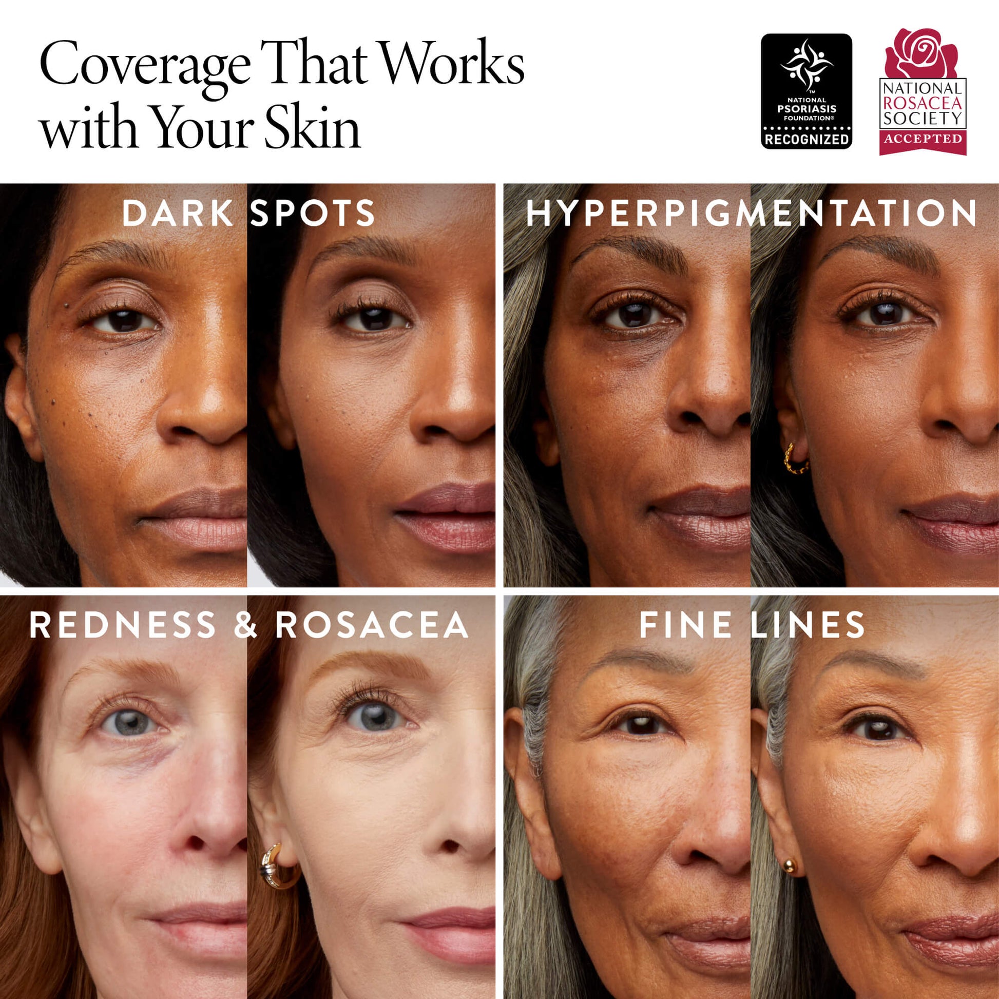 Baked Balance-n-Glow Illuminating Foundation Skin Concerns