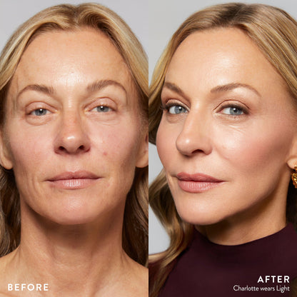 before and after