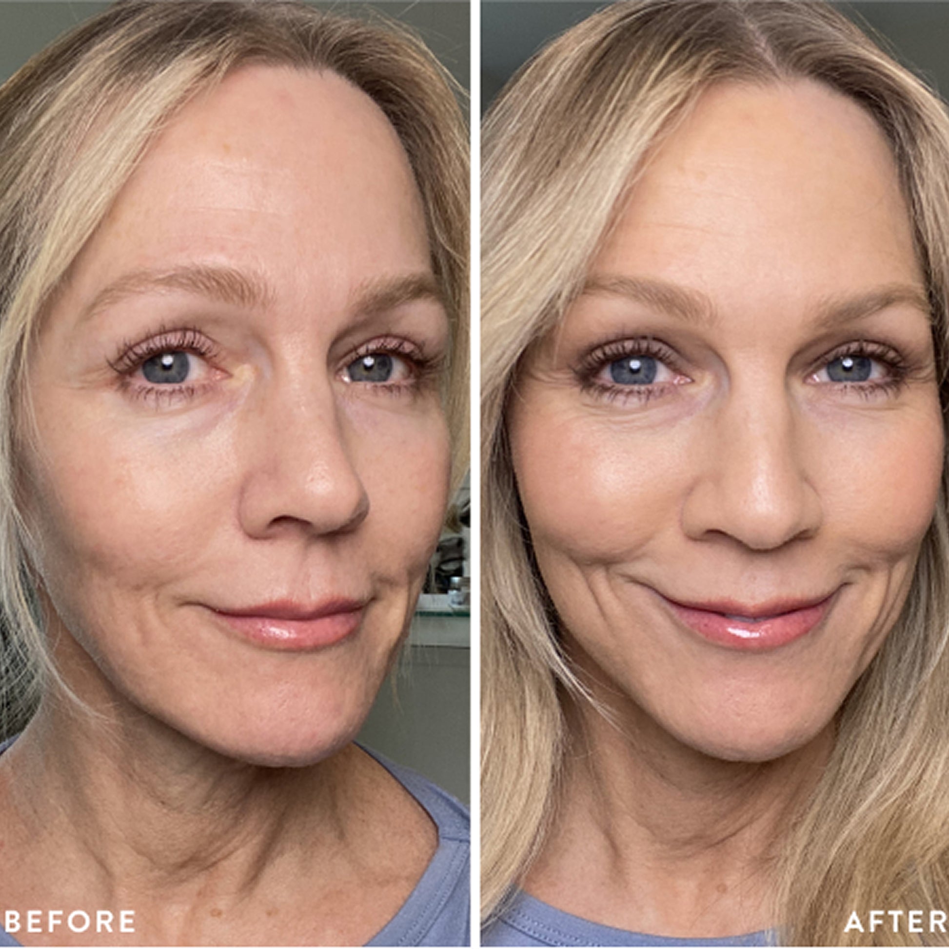 jennie garth B&A